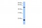 DYX1C1 antibody - C-terminal region