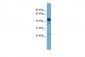 DYX1C1 antibody - middle region