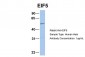 EIF5 antibody - N-terminal region