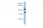 IL13RA2 antibody - middle region