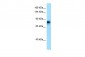 ADAM2 antibody - N-terminal region