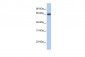 FEM1B antibody - C-terminal region