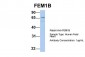 FEM1B antibody - C-terminal region