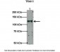 TRAK1 antibody - middle region