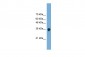 FRZB antibody - middle region