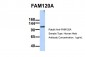 FAM120A antibody - middle region
