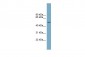FAM98A antibody - middle region