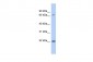 RPS7 antibody - N-terminal region