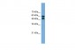 PGM1 antibody - middle region