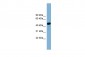 LANCL2 antibody - middle region