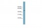 LANCL2 antibody - middle region