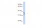 DBP antibody - middle region