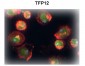 TFPI2 antibody - middle region