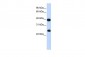 H2AFY antibody - middle region