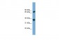 POT1 antibody - middle region