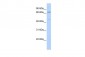 KLHL15 antibody - middle region