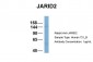 JARID2 antibody - N-terminal region
