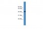 SERPINB13 antibody - middle region