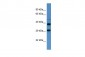 SSTR2 Antibody - C-terminal region