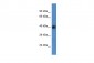 AGPAT3 antibody - middle region