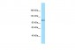 FCRL5 Antibody - C-terminal region