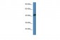 ACTA1 antibody - N-terminal region