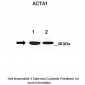 ACTA1 antibody - N-terminal region