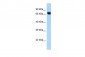 ACSS2 antibody - C-terminal region