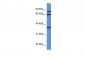 DHPS antibody - N-terminal region