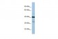 PTGDR antibody - C-terminal region