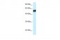 CAMK4 antibody - N-terminal region