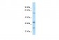 MAD2L1BP antibody - N-terminal region