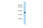 CYSLTR1 antibody - C-terminal region