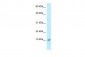 S100A8 antibody - middle region
