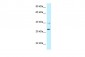 TNFRSF14 antibody - middle region