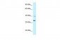 TNFRSF14 antibody - middle region