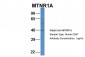 MTNR1A antibody - C-terminal region