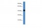 PRKAR2A antibody - middle region