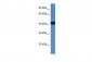 PRKAR2A antibody - middle region