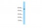 IFIT1 Antibody - C-terminal region