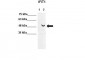 IFIT1 Antibody - C-terminal region