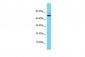 SCARB2 Antibody - C-terminal region