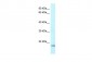 UBE2V1 antibody - C-terminal region