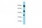 RARRES1 Antibody - middle region