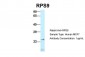 RPS9 antibody - N-terminal region