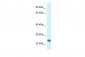 NDUFS8 antibody - C-terminal region