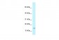 RPP21 antibody - middle region