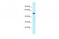 ARFGAP3 antibody - C-terminal region