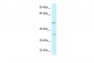 PFKFB1 antibody - C-terminal region