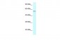 CYP2U1 antibody - middle region